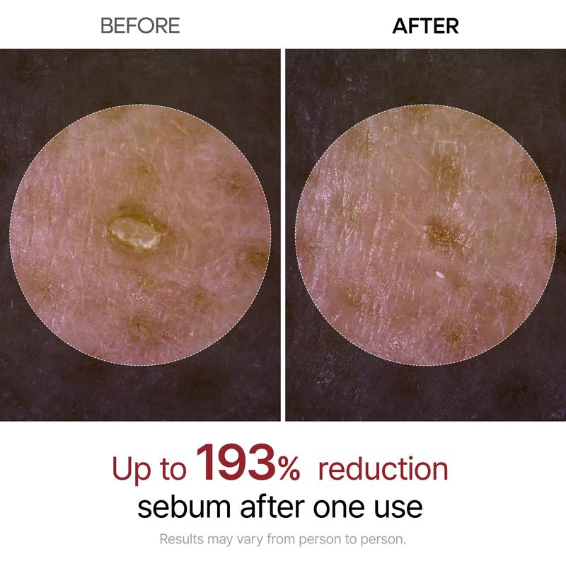 Peel Shot Glow