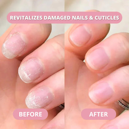 Nail Growth Pen