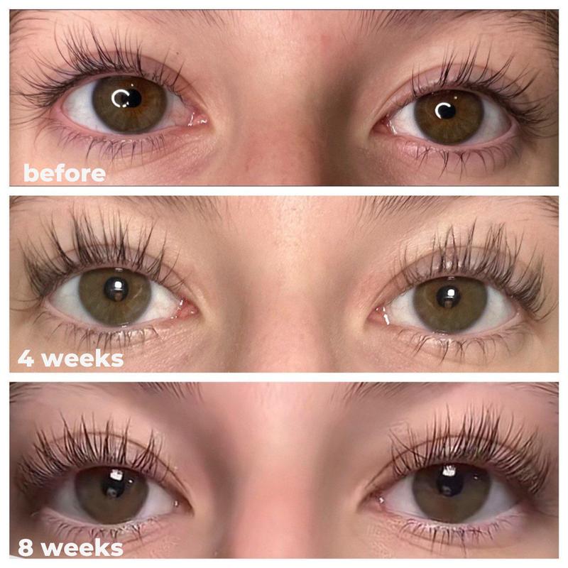 LashRX Eyelash Serum